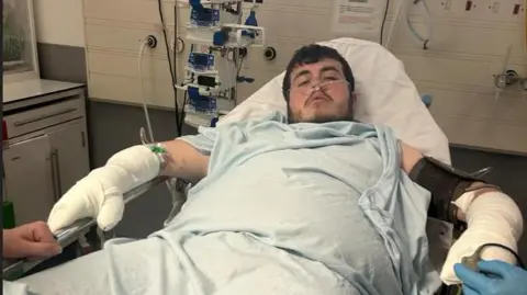 La fotografía de William Newbury de William Newbury se sentó en una cama de hospital. Lleva un tubo de oxígeno y tiene una lámina azul que cubre el cuerpo al cuello. Tiene cabello corto marrón y una barba marrón. Ambos brazos están envueltos en tela blanca. Parece aturdido en la cámara. 