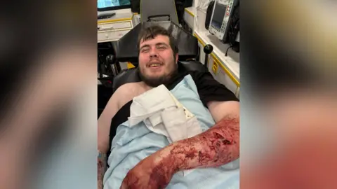 William Newbury, el Sr. Newbury, en la foto sonriente, se dirigió a una cama de ambulancia. Tiene cabello castaño y una barba marrón. El brazo izquierdo descansa sobre el estómago y está cubierto de sangre. Puedes ver cortes y brotes en el brazo. Una manta azul cubre su cuerpo en su pecho. 